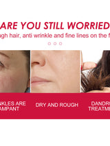 Rosehip Face & Body Oil — Deep Hydration & Glowing Skin