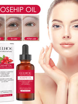 Rosehip Face & Body Oil — Deep Hydration & Glowing Skin