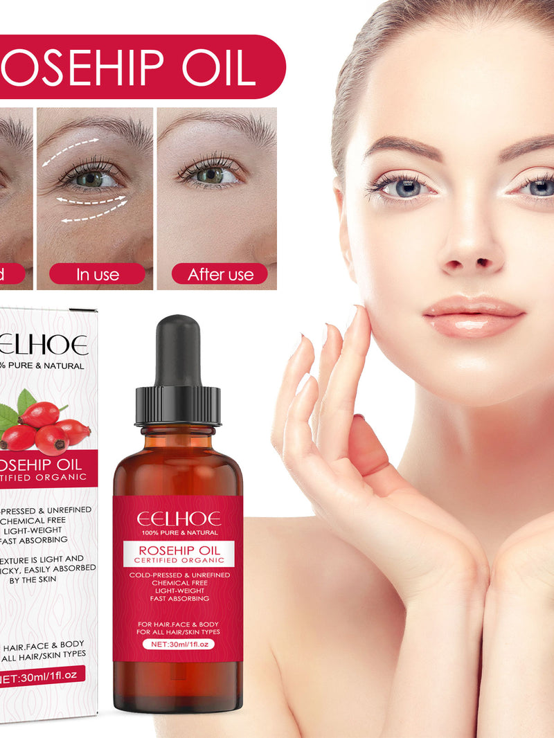 Rosehip Face & Body Oil — Deep Hydration & Glowing Skin